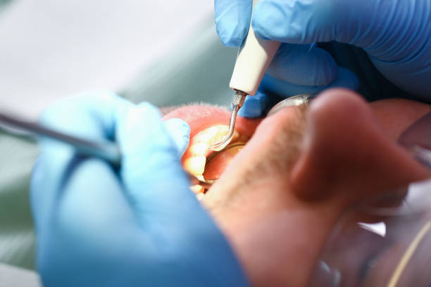 Best Dentist for Severe Toothache  in Rose Hill, VA