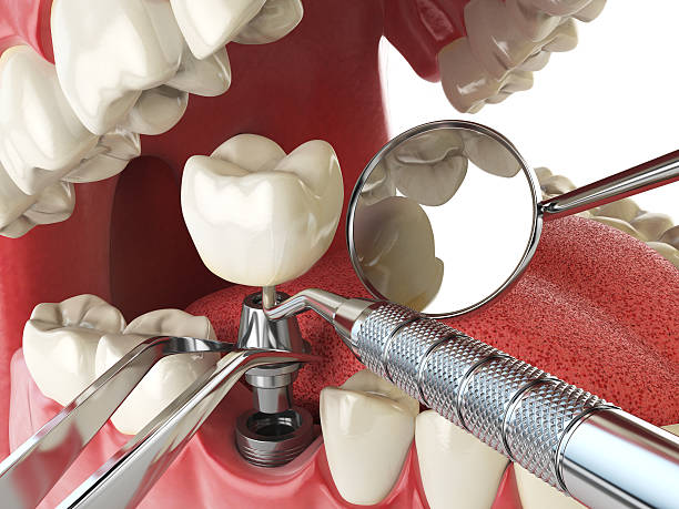 Best Emergency Gum Pain Relief  in Rose Hill, VA